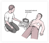 Oživljanje z avtomatskim električnim defibrilatorjem